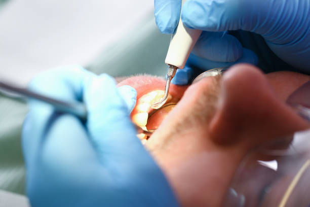 Professional Emergency Dentist in WY