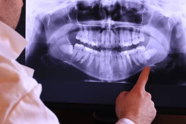Best Emergency Root Canal Treatment in Jackson, WY