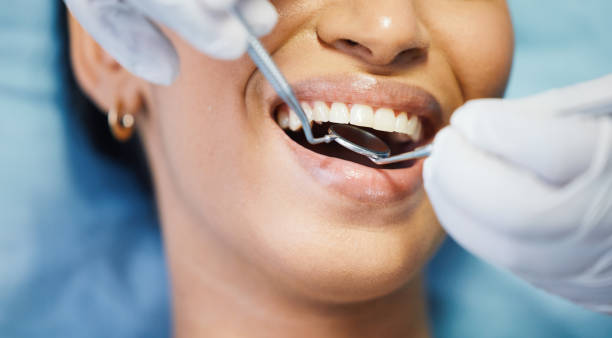 Best Emergency Root Canal Treatment in Jackson, WY